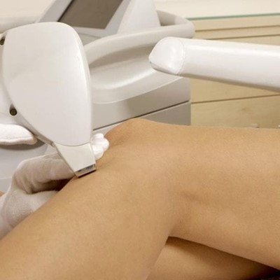 Elimina el vello de forma permanente: ¡comienza ya las sesiones de fotodepilación en Pontevedra!
