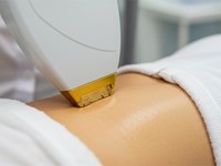 ¿Es la fotodepilación dolorosa?