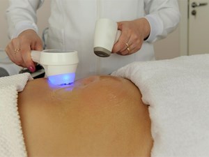 Radiofrecuencia Indiba Corporal: el secreto para una piel más firme y una silueta definida