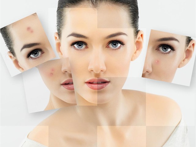 Reequilibrante pieles grasas 